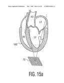 Three Dimensional Ultrasonic Scanning With a Steerable Volumetric Region diagram and image