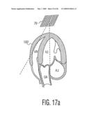 Three Dimensional Ultrasonic Scanning With a Steerable Volumetric Region diagram and image