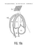 Three Dimensional Ultrasonic Scanning With a Steerable Volumetric Region diagram and image