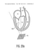 Three Dimensional Ultrasonic Scanning With a Steerable Volumetric Region diagram and image