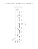 Calculating Respiration Parameters Using Impedance Plethysmography diagram and image