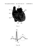 RAPID METHOD FOR ANALYZING BIO-SIGNAL INSTANTANEOUSLY BY PHASE SPACE DIFFERENCE AND ITS DEVICE diagram and image