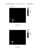 RAPID METHOD FOR ANALYZING BIO-SIGNAL INSTANTANEOUSLY BY PHASE SPACE DIFFERENCE AND ITS DEVICE diagram and image