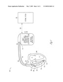 METHOD AND APPARATUS FOR CARDIAC ARRHYTHMIA CLASSIFICATION USING SAMPLE ENTROPY diagram and image