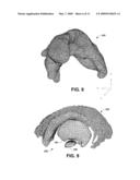 AUTOMATED 3D BRAIN ATLAS FITTING USING INTRA-OPERATIVE NEUROPHYSIOLOGICAL DATA diagram and image