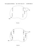 BIOPSY PLANNING AND DISPLAY APPARATUS diagram and image