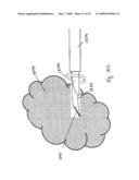 Devices, Methods, and Kits for a Biopsy Device diagram and image