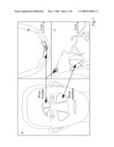 Human Cavity Gas Measurement Device And Method diagram and image