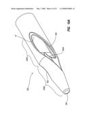 CATHETER ASSEMBLY INCLUDING TRIPLE LUMEN TIP diagram and image