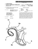 Method and implantable device for measuring hematocrit diagram and image