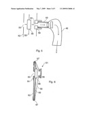 COLOSTOMY ARRANGEMENTS diagram and image