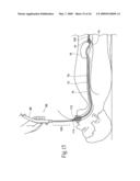 Systems and methods for treating obesity and other gastrointestinal conditions diagram and image