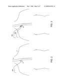 METHODS AND APPARATUS FOR INSERTING MULTI-LUMEN SPLIT-TIP CATHETERS INTO A BLOOD VESSEL diagram and image