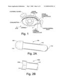 Treatment Medium Delivery Device and Methods for Delivery of Such Treatment Mediums to the Eye Using such a Delivery Device diagram and image