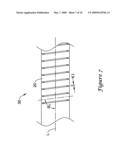 INTERCONNECTED RIBBON COILS, MEDICAL DEVICES INCLUDING AN INTERCONNECTED RIBBON COIL, AND METHODS FOR MANUFACTURING AN INTERCONNECTED RIBBON COIL diagram and image