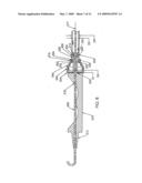 Method for Using a Guidewire Straightener diagram and image