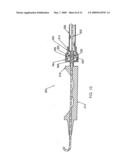 Method for Using a Guidewire Straightener diagram and image