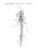 Method for Using a Guidewire Straightener diagram and image