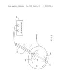 SYSTEM AND METHOD FOR TISSUE ABLATION diagram and image