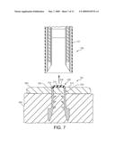 Implantation System for Tissue Repair diagram and image