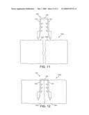 Implantation System for Tissue Repair diagram and image