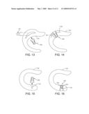 Implantation System for Tissue Repair diagram and image