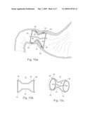 Pyloric Devices and Methods diagram and image