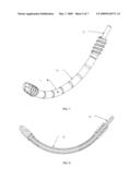 CURVED ASSEMBLY FOR REATTACHMENT OF FRAGMENTED BONE SEGMENTS diagram and image