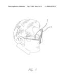 Video Processing Unit for a Visual Prosthetic Apparatus diagram and image