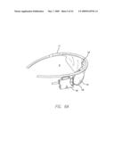 Video Processing Unit for a Visual Prosthetic Apparatus diagram and image