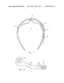 Video Processing Unit for a Visual Prosthetic Apparatus diagram and image