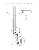 EXTERNAL CONTROLLER FOR AN IMPLANTABLE MEDICAL DEVICE SYSTEM WITH COUPLEABLE EXTERNAL CHARGING COIL ASSEMBLY diagram and image