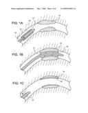 ENDOPROSTHESIS COATING diagram and image