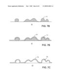 ENDOPROSTHESIS COATING diagram and image