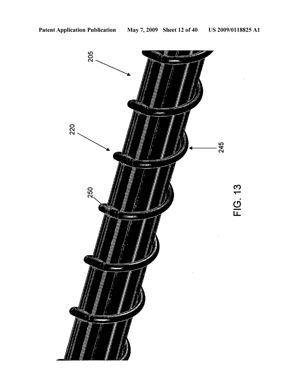 METHOD AND APPARATUS FOR IMPROVING MITRAL VALVE FUNCTION - diagram, schematic, and image 13