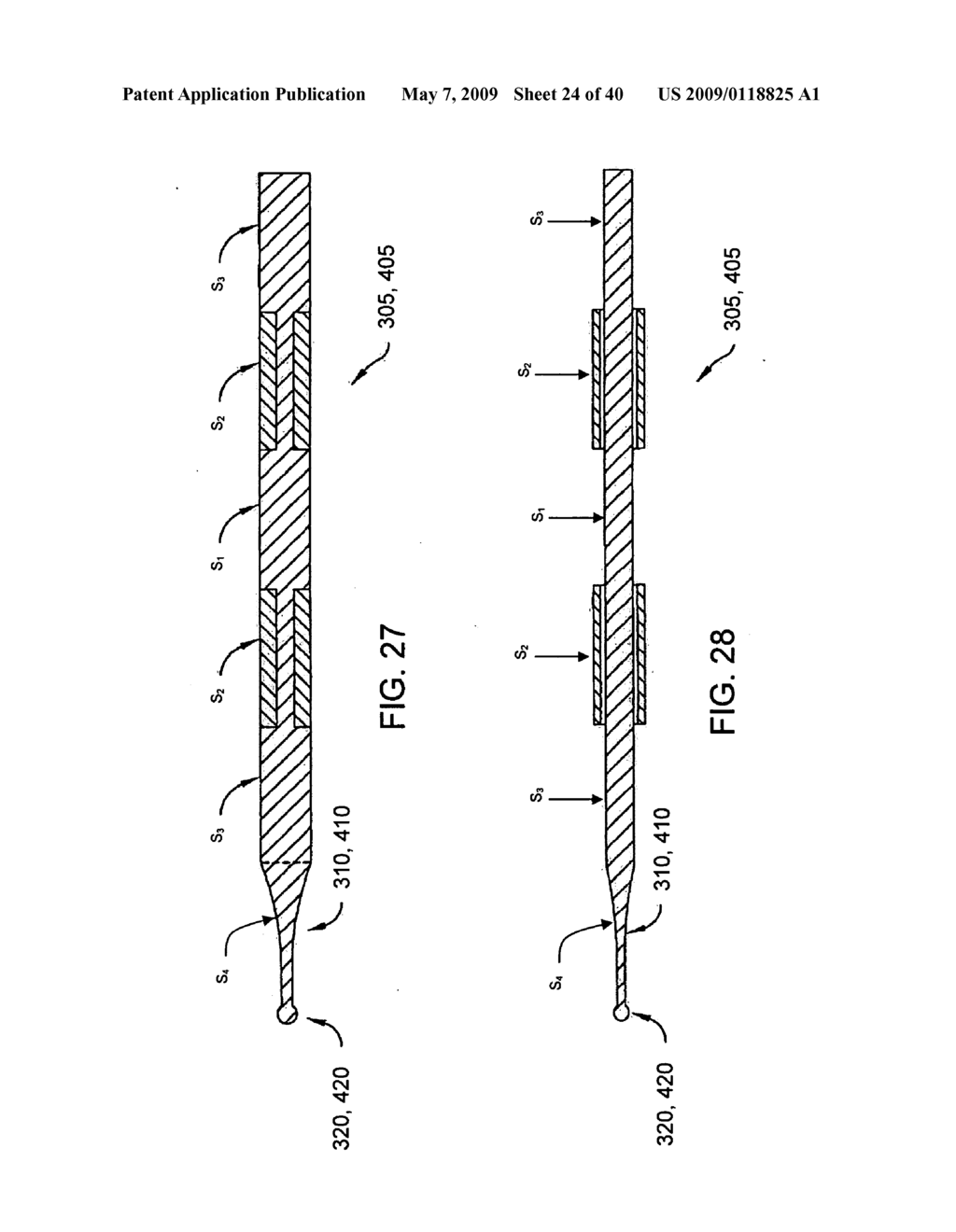 METHOD AND APPARATUS FOR IMPROVING MITRAL VALVE FUNCTION - diagram, schematic, and image 25