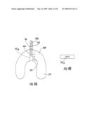 READERS THAT COOPERATE WITH SINGLE-USE INTERNAL DOSIMETERS FOR DETECTING RADIATION IN MEDICAL PROCEDURES/THERAPIES diagram and image