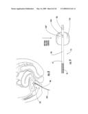 READERS THAT COOPERATE WITH SINGLE-USE INTERNAL DOSIMETERS FOR DETECTING RADIATION IN MEDICAL PROCEDURES/THERAPIES diagram and image