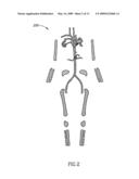 Bone Segmentation diagram and image