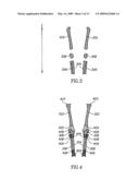 Bone Segmentation diagram and image