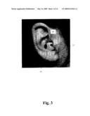 HEARING DEVICE WITH AN OPEN EARPIECE HAVING A SHORT VENT diagram and image