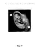 HEARING DEVICE WITH AN OPEN EARPIECE HAVING A SHORT VENT diagram and image