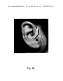 HEARING DEVICE WITH AN OPEN EARPIECE HAVING A SHORT VENT diagram and image