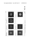 DETECTION OF CIRCULATING TUMOR CELLS IN PERIPHERAL BLOOD WITH AN AUTOMATED SCANNING FLUORESCENCE MICROSCOPE diagram and image