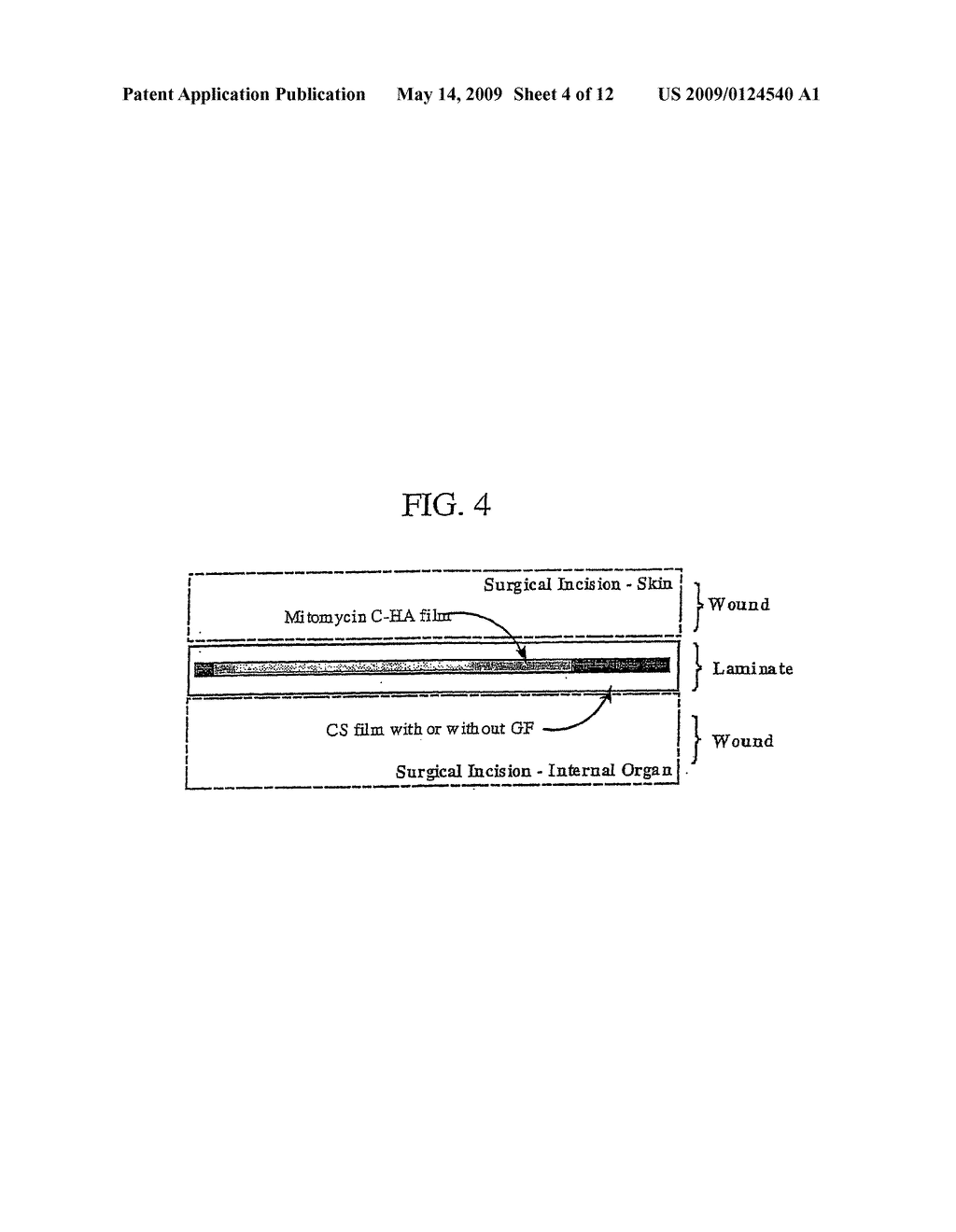 Anti-adhesion composites and methods of use thereof - diagram, schematic, and image 05