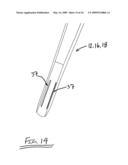 Surgical access system and related methods diagram and image