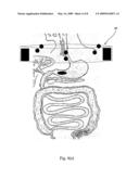 Tracking system diagram and image