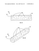 MARKERS FOR USE IN BRACHYTHERAPY AND OTHER RADIATION THERAPY THAT RESIST MIGRATION AND ROTATION diagram and image