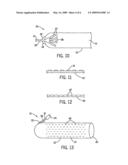 Wound Chamber For Limb diagram and image