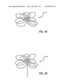 TETHERED COIL FOR TREATMENT OF BODY LUMENS diagram and image